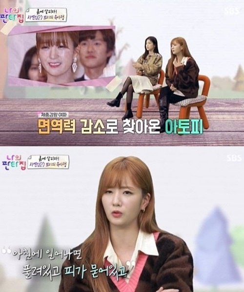 ì—ì´í•'í¬ ë³´ë¯¸ ê¸‰ê²©í•œ ë‹¤ì´ì–´íŠ¸ë¡œ ë¶€ìž'ìš© ì•„í† í