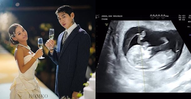트루디♥이대은, 부모된다 11월 출산…태명은 금똥이