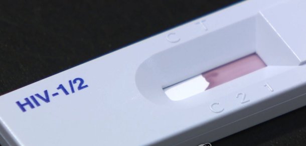 韓国人の新規HIV感染者、3年連続減少…20年で600人：ネイトニュース