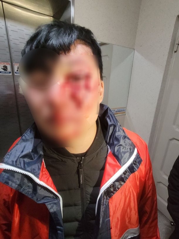 前 민주당 총선 예비후보에 폭행당해 전치 6주 상처 입은 배달 라이더./피해자 제공
