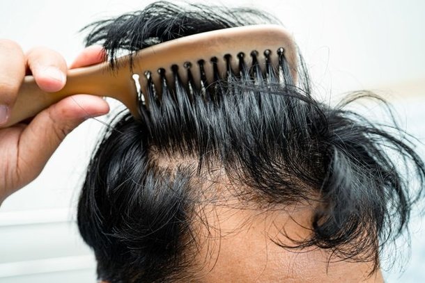 Autumn hair shedding is a normal seasonal phenomenon