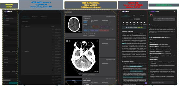 제이엘케이, 의료영상 특화 LLM 플랫폼 론칭…CT·MRI 분석