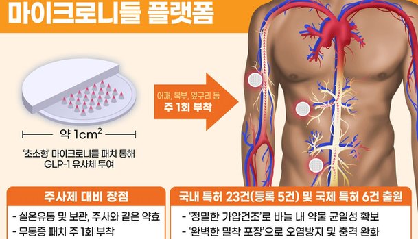 쿼드 근육 다이어그램