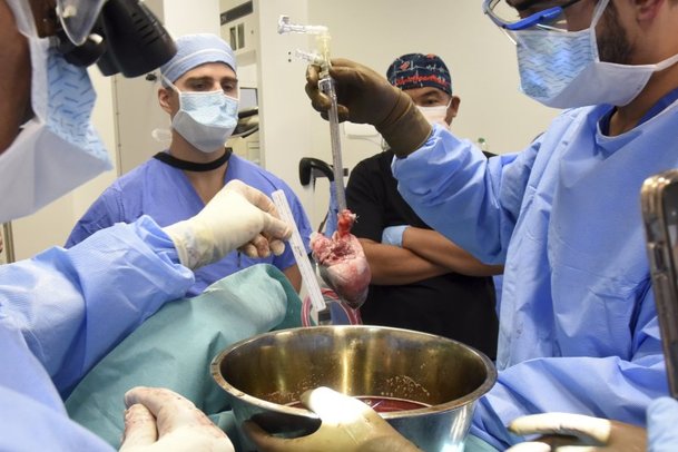 미 메릴랜드 의대 외과 의사들이 지난 20일 58살의 로렌스 포셋에게 사상 2번째 인간에 대한 돼지 심장 이식 수술을 준비하고 있다. /사진=뉴시스