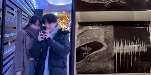 [팝업★]서민재 열애+임신 발표, 고백 아닌 폭로였다…스토킹 피소 위기(종합)