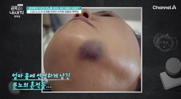 &apos;금쪽&apos; 母 목 조르는 중2 아들…긴급 촬영 중단 사태까지