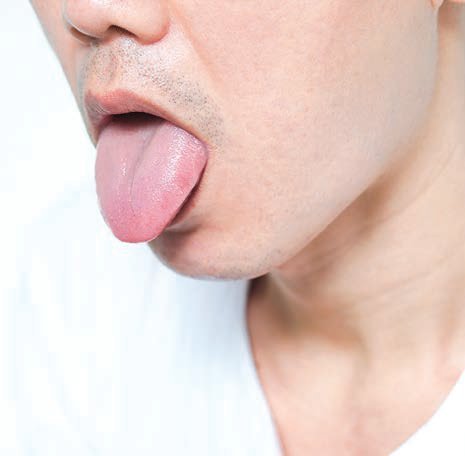 거울 보다 발견한 붉은 혀 상처…설암 위험 두배 높이는 이것 [건강한 가족]