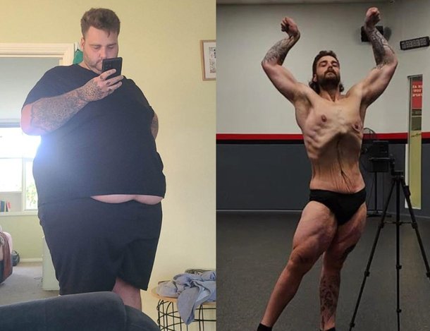 “When I was 270kg, my heart stopped three times a day”… A 27-year-old man weighing 106kg reveals his harsh story: Nate News