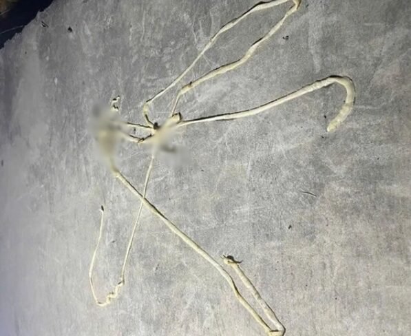 排便中10mの長さ「これ」一緒によもぎ～抜け出て…正体何だった？ : ネイトニュース