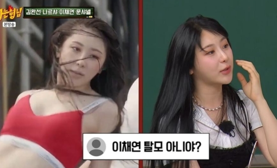 25세 이채연, 모발이식 고백 워터밤 이후 탈모설 돌아 (아형)