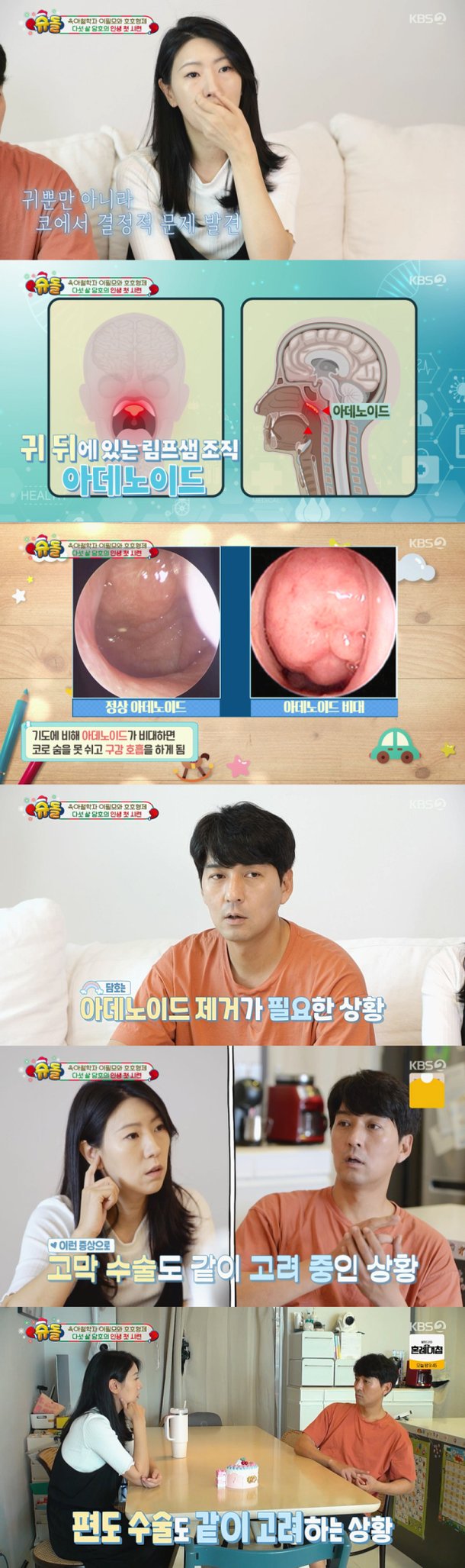 아데노이드 기능