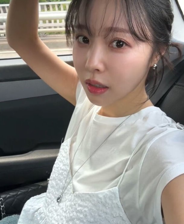 &apos;여성암 투병&apos; 이솔이, 동안형으로 얼굴 변화→턱선 마음에 들어