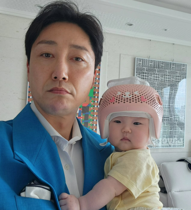 개그맨 손헌수, 5개월 딸 &apos;두상 헬멧&apos; 쓴다는데…인생 첫 고비