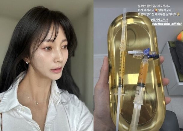안혜경, 동안 비결은 줄기세포 주사?…망가진 피부 살려줘 [MD★스타]