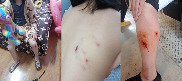 기사 이미지