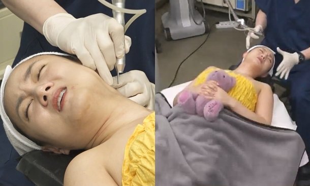 수치스럽다 박나래, 탈모 전문 병원 찾았다…두피 상태에 충격