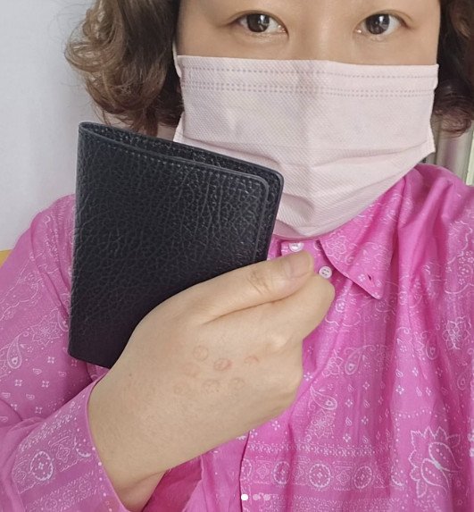 신기루, 사전투표 인증 오해받을까…후보 수 대로 손등 도장 [N샷]