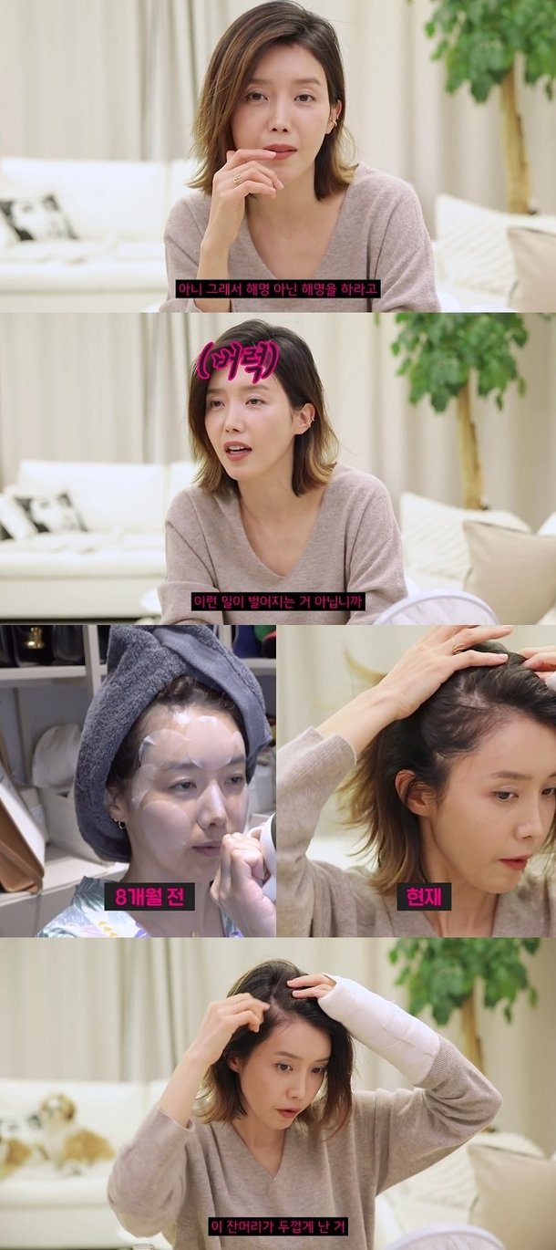 ì±„ì •ì•ˆ íƒˆëª¨ ê·¹ë³µ ê°€ì§œ ë…¼ëž€ ì§ì ' ë³´ì—¬ë