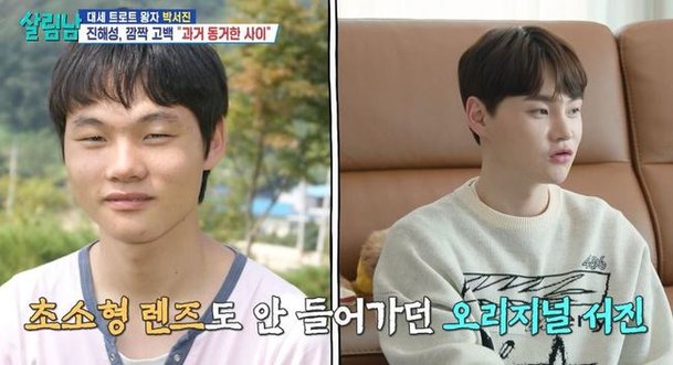 비포 박서진, 성형 전 오리지널 눈 크기 렌즈도 안 들어가(살림남)[결정적장면]