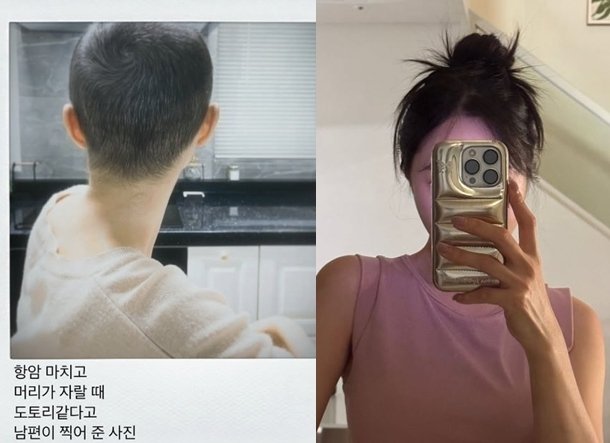 가발 예쁘게 맞췄던 이솔이, 여성암 극복 후 이제는 머리 삐죽삐죽…훈훈한 건강 회복