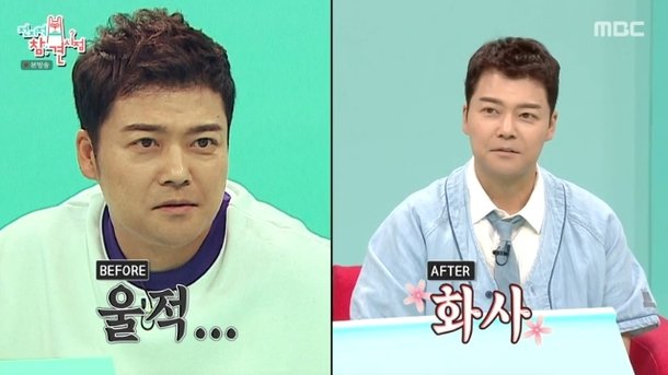 전현무 눈밑 지방 재배치 전후 비교샷 공개, 화사해진 얼굴로 만족도 높아(전참시)