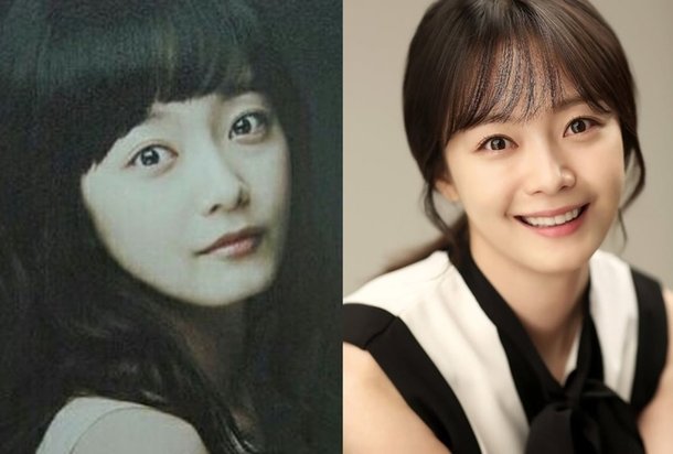 전소민, 2300만원 성형 견적 도망쳤다더니…모태미녀 잘 자랐네 20대부터 30까지