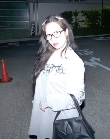 볼 통통 현아, ♥용준형 신혼 얼마나 좋으면…날아간 눈코입에도 행복 뿜뿜
