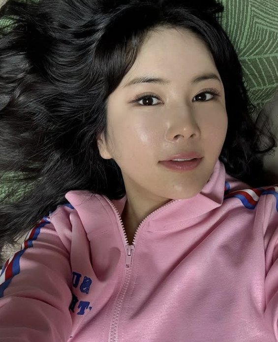장영란 4번째 눈성형 완전 자리잡았네, 누워도 굴욕無 미모 ♥한창 좋겠어