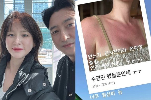 이혜원, 수영만 했을 뿐인데 일광화상 ♥안정환 온종일 놀려 속상