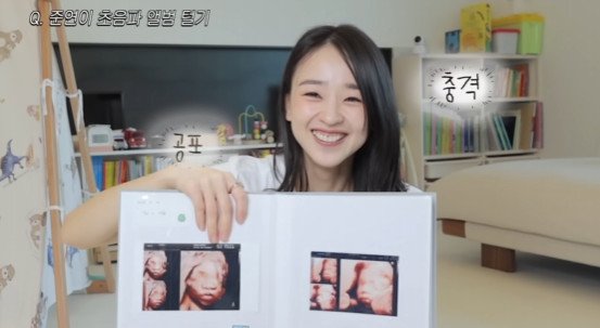 손연재 子 초음파, ♥남편 너무 닮아 충격…기분 안 좋아 다시 찍어