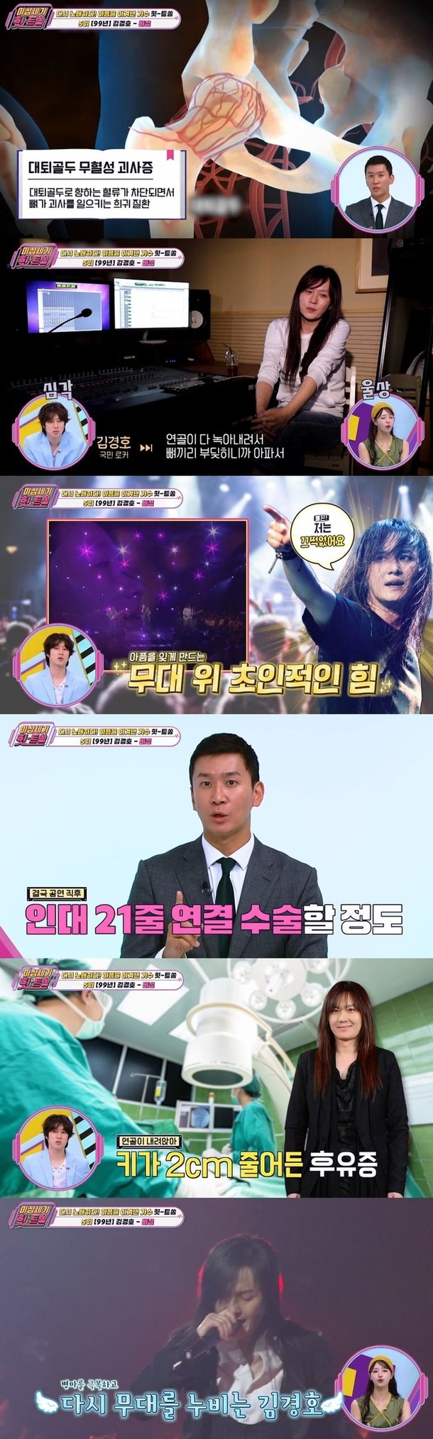 김경호 대퇴골두 무혈성 괴사증, 인대 21줄 연결 대수술 