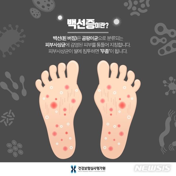 개 뱃속에 백선