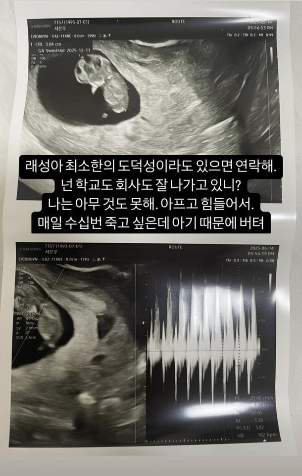 &apos;임신&apos; 서민재, 남친에 연락 요청 수십번 죽고 싶은데 아기때문에…