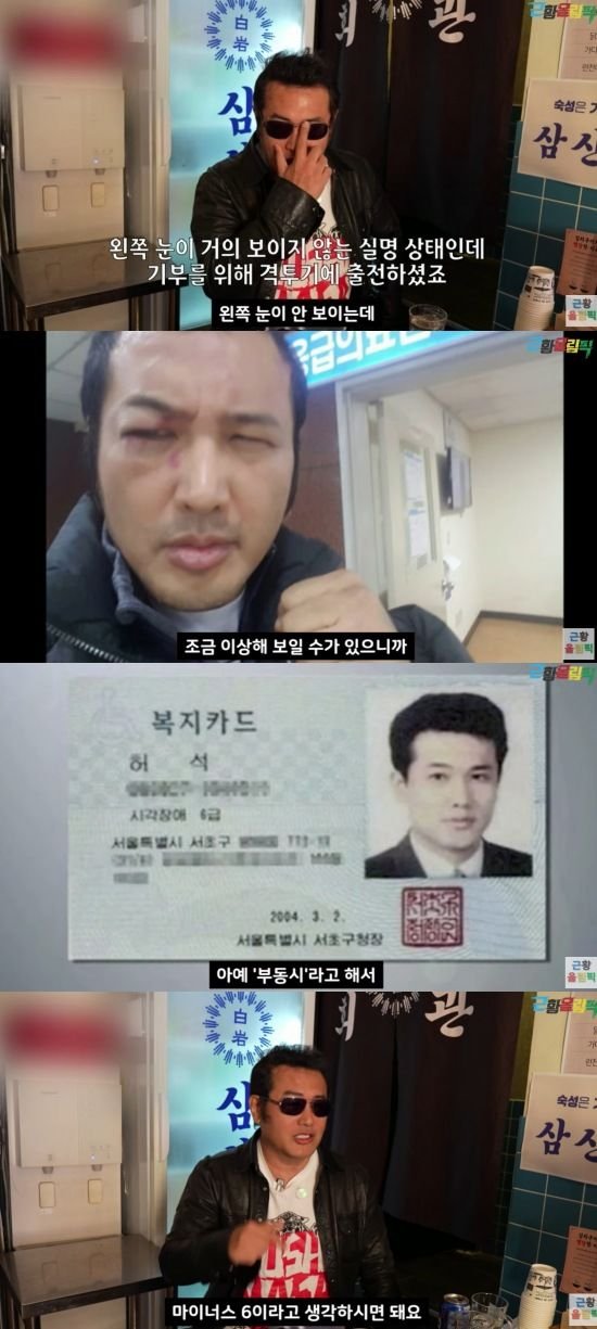김보성 왼쪽 눈 실명…오른쪽 시력도 마이너스 6
