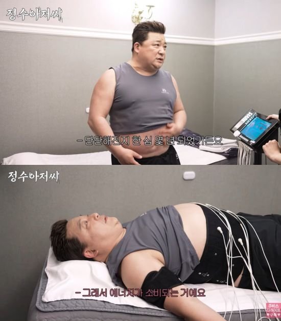 105㎏ 윤정수 지방흡입 후 10년 넘게 배 단단
