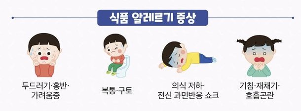 Food Allergy Symptoms: What to Watch For - News Directory 3