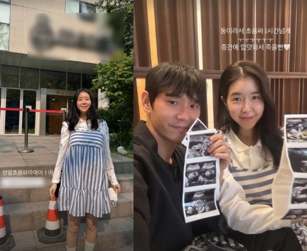 &apos;쌍둥이 임신&apos; 김지혜, 진료받다 죽을 뻔한 경험 둥이라 1시간 넘게…