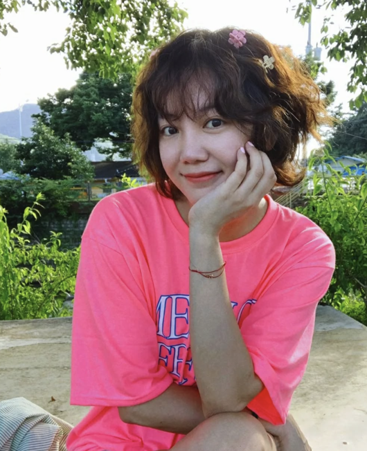 고은아, 중형차값 코 재건수술 후 경사 맞았다…억지로 만들지 않아