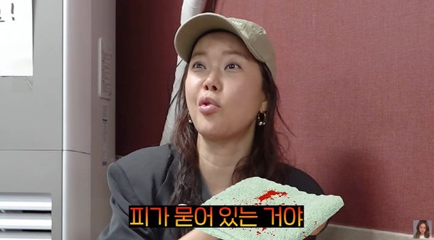 백지영, 수건에 피 흥건 '충격'…몸 적신호 켜졌나 &quot;지렁이 같은 고름 나와&quot; ('백지영') [종합]