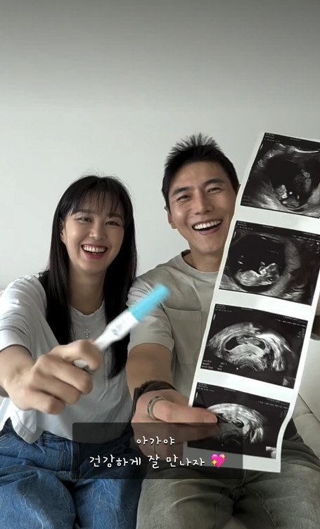 송재희♥지소연, 유산 아픔 극복 후 둘째 임신 "시험관이라 임밍아웃 못해" [전문]