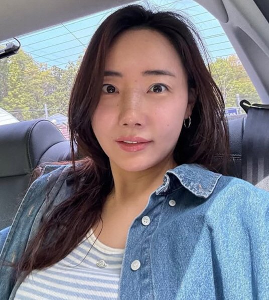 &apos;조혜련 올케&apos; 박혜민, 코수술 후 물오른 미모 추가 성형? 억울