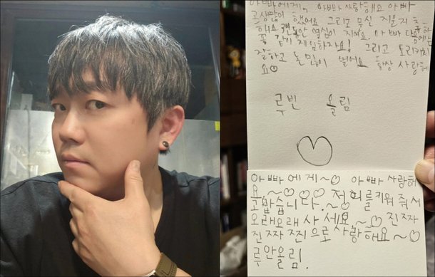 송백경, 문신 지운 보람 있네…아들 손편지에 감격 3년 동안 열심히 지워요