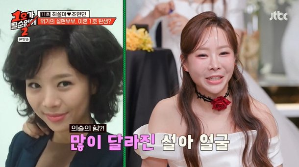 최설아 눈·코 성형, 허벅지·아랫배 지방흡입도…난 부작용 아이콘 (&apos;1호가&apos;)