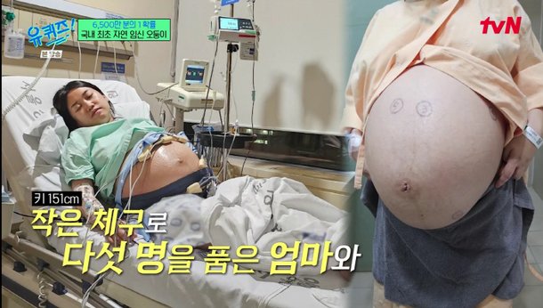 &apos;오둥이 자연임신&apos; 부부 경제적 두려움에 매일 울어, 선택적 유산 권유받기도(유퀴즈)[종합]