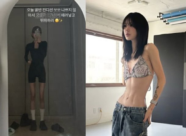 &apos;故 최진실 딸&apos; 최준희, 고작 23살인데…&apos;골반 괴사 진행 중&apos; 안타까운 근황