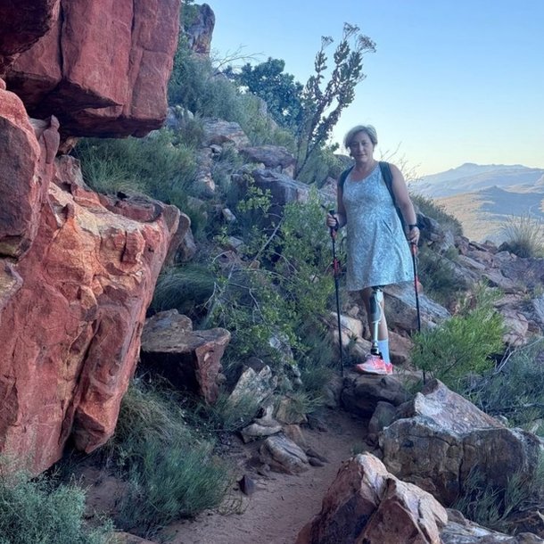 Woman Loses Leg After Mistaking Deadly Infection for a Cold | South Korea News - News Directory 3