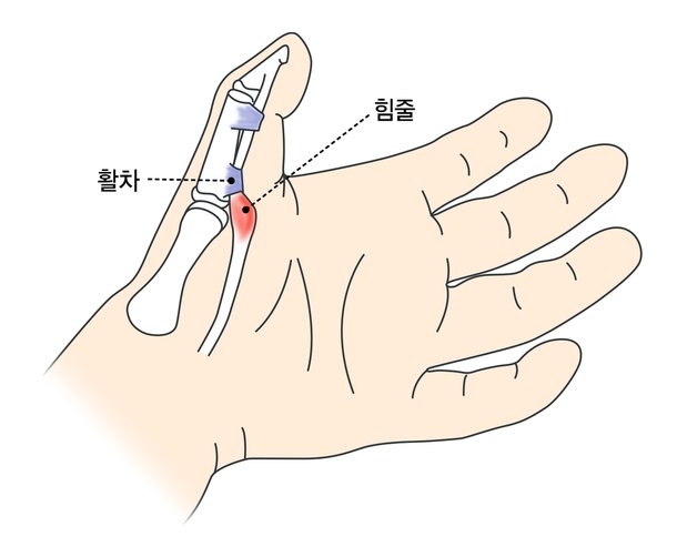 딸깍 소리