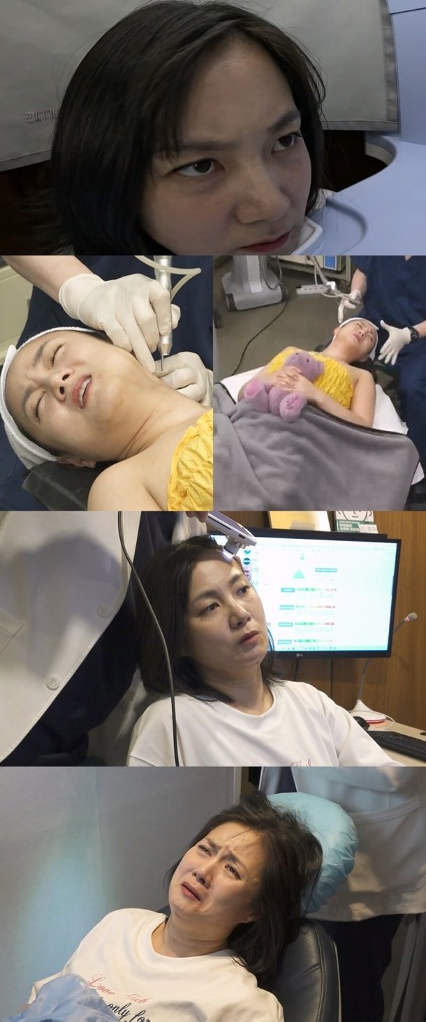 박나래, 탈모 고민 있었다 인정하기까지 시간 걸려(&apos;나혼산&apos;)