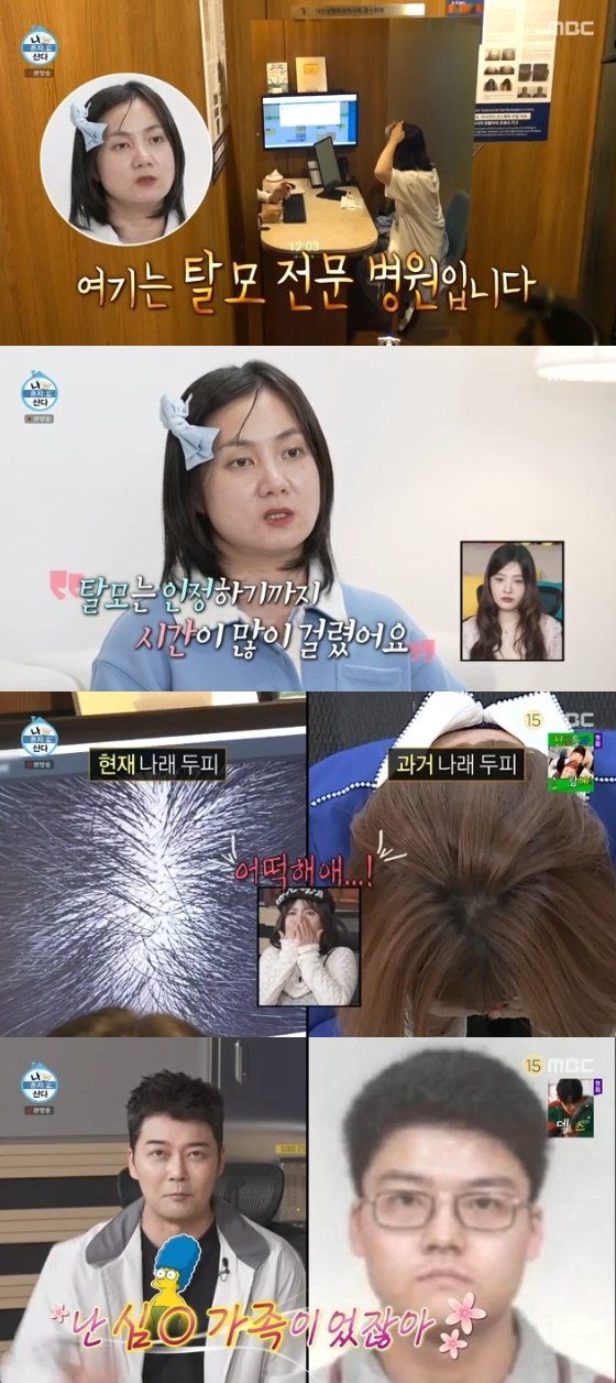 Park Narae’s Shocking Hair Loss Revelation