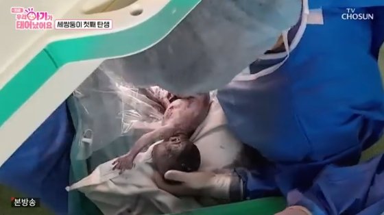 의료진 16명 투입, 세쌍둥이 탄생 셋 다 호흡곤란에…둘째 기형 父 근심 [우리 아기가 태어났어요][★밤TV]